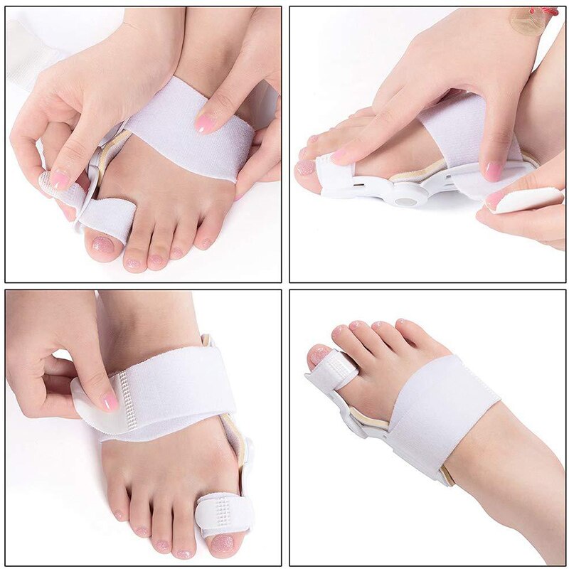 Flexible Bunion Corrector