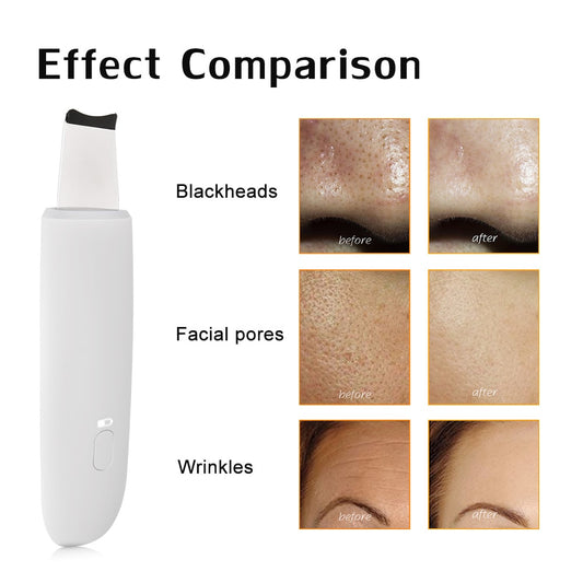 Ultrasonic Skin Scrubber